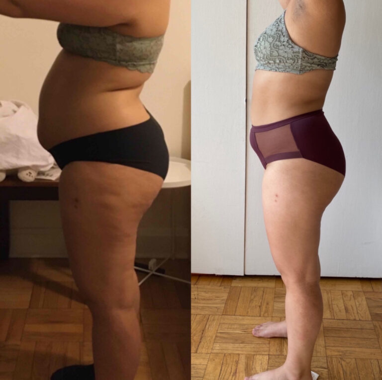NEW - BEFORE_AFTER4